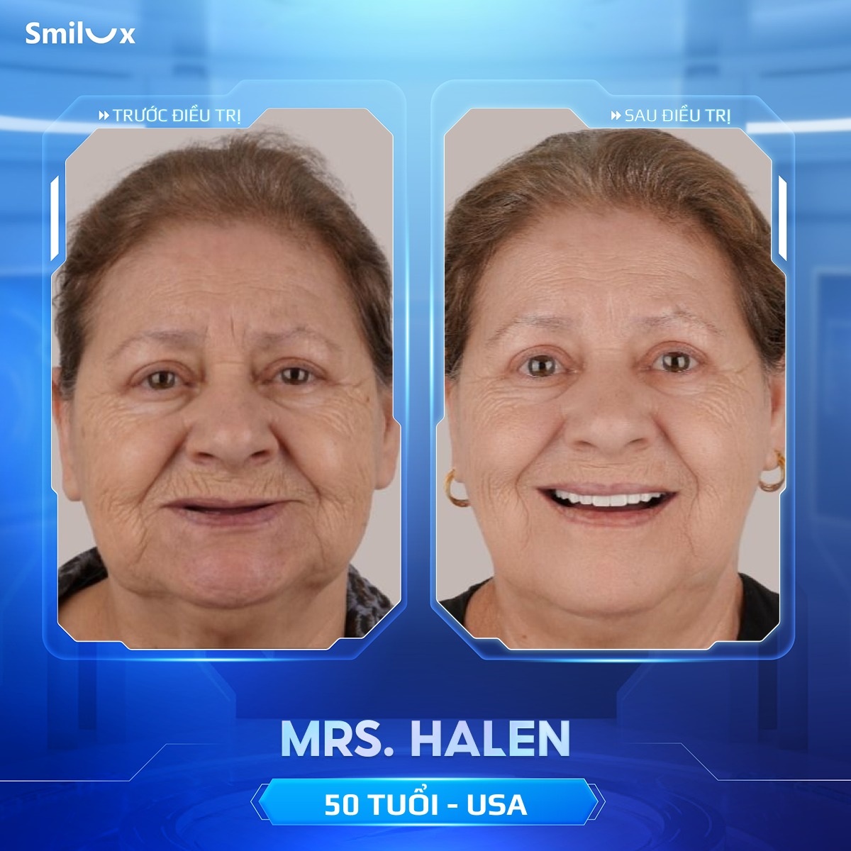 khách hàng implant 2