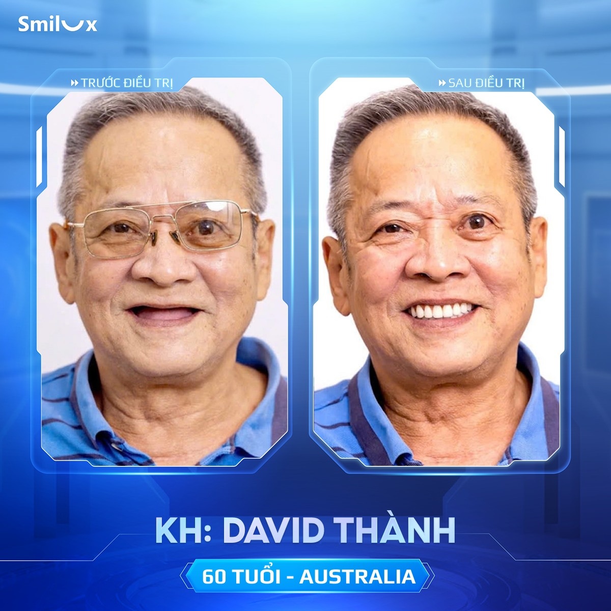 khách hàng implant 4