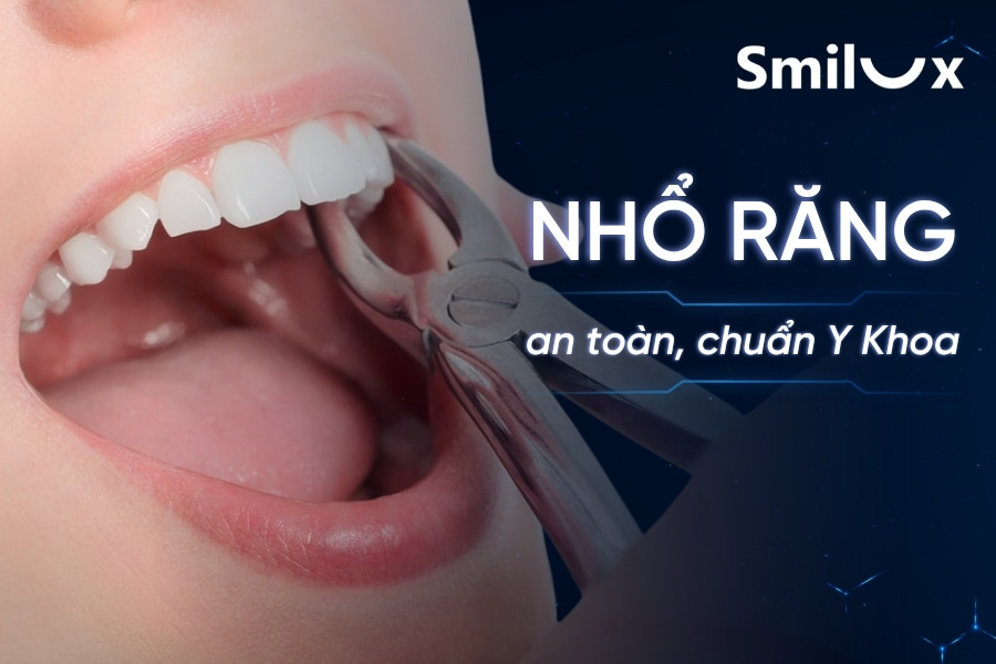 Trường hợp nào bắt buộc nhổ răng? Chi phí và quy trình thực hiện thế nào? Trường hợp nào bắt buộc nhổ răng? Chi phí và quy trình thực hiện thế nào?