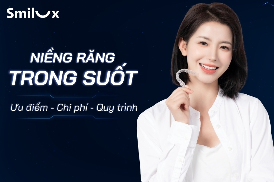Niềng răng trong suốt: Ưu điểm, chi phí và quy trình thực hiện Niềng răng trong suốt: Ưu điểm, chi phí và quy trình thực hiện
