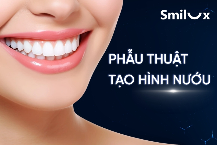 Phẫu thuật tạo hình nướu: Lợi ích, quy trình, chi phí thực hiện Phẫu thuật tạo hình nướu: Lợi ích, quy trình, chi phí thực hiện