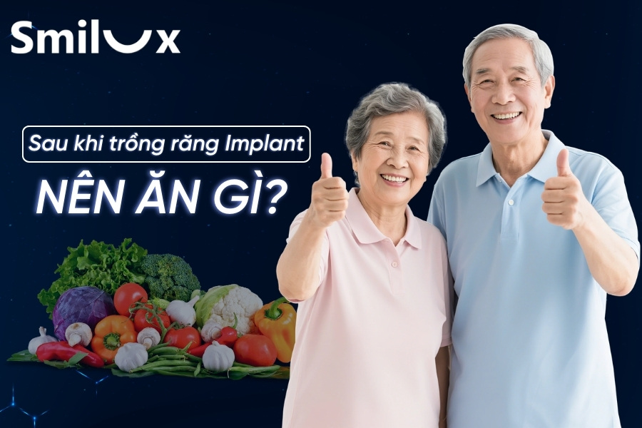 Sau khi trồng răng Implant nên ăn gì để nhanh hồi phục? Sau khi trồng răng Implant nên ăn gì để nhanh hồi phục?