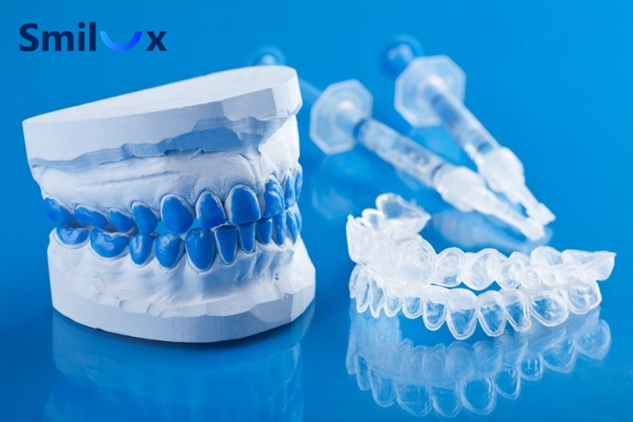 Tẩy trắng tại nhà bằng máng dưới sự hướng dẫn của bác sĩ Tẩy trắng tại nhà bằng máng dưới sự hướng dẫn của bác sĩ