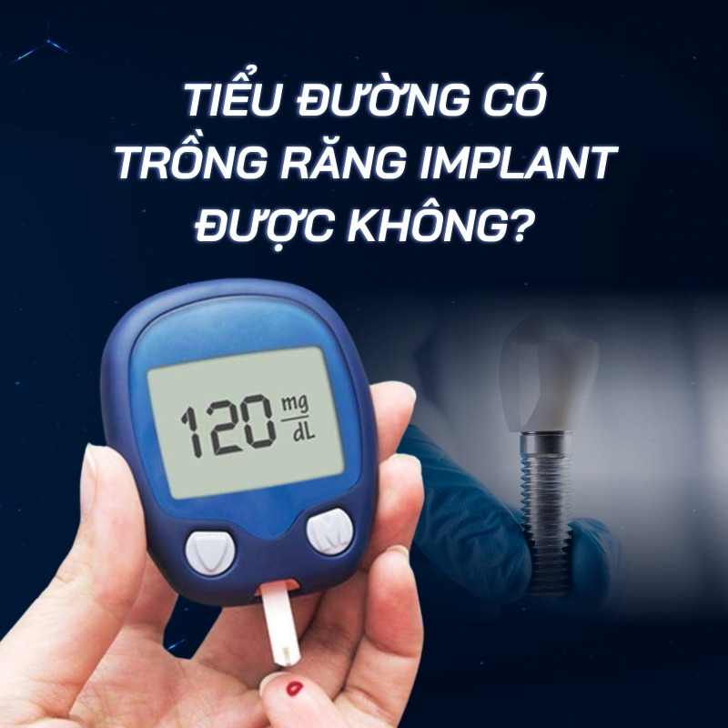 tiểu đường có trồng răng Implant được không smilux dental