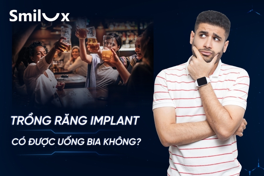 Trồng răng Implant có uống bia được không? Kiêng bao lâu? Trồng răng Implant có uống bia được không? Kiêng bao lâu?