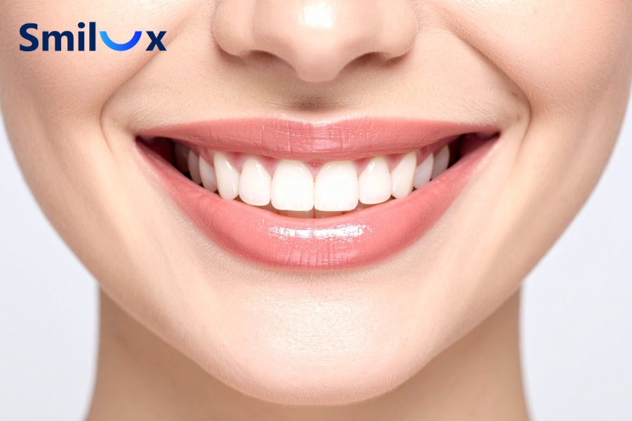 Hạn chế lở loét, nhiệt miệng Hạn chế lở loét, nhiệt miệng
