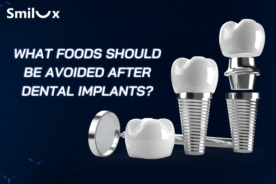 What foods should be avoided after dental implants? What foods should be avoided after dental implants?