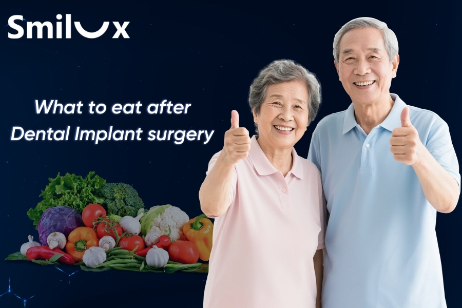 What to eat after dental implant surgery? What to eat after dental implant surgery?