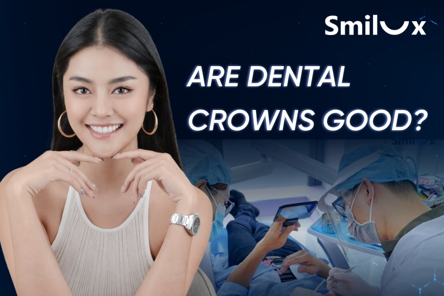 Are Dental Crowns Good? Should You Get Dental Crowns? Are Dental Crowns Good? Should You Get Dental Crowns?