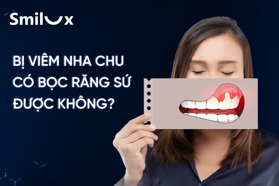 Bị nha chu có bọc răng sứ được không? Smilux Dental giải đáp Bị nha chu có bọc răng sứ được không? Smilux Dental giải đáp