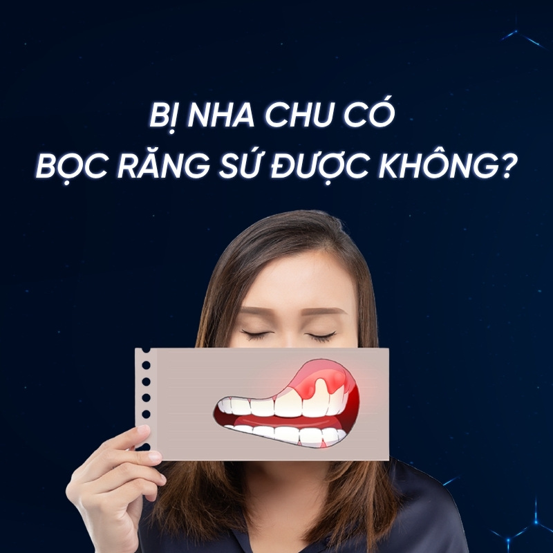 Bị nha chu có bọc răng sứ được không? Smilux Dental giải đáp