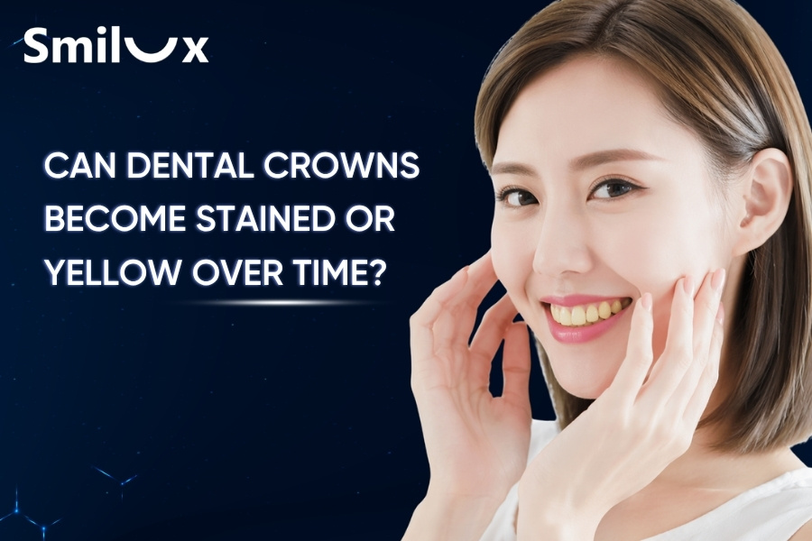 Can Dental Crowns Become Stained or Yellow Over Time? Can Dental Crowns Become Stained or Yellow Over Time?