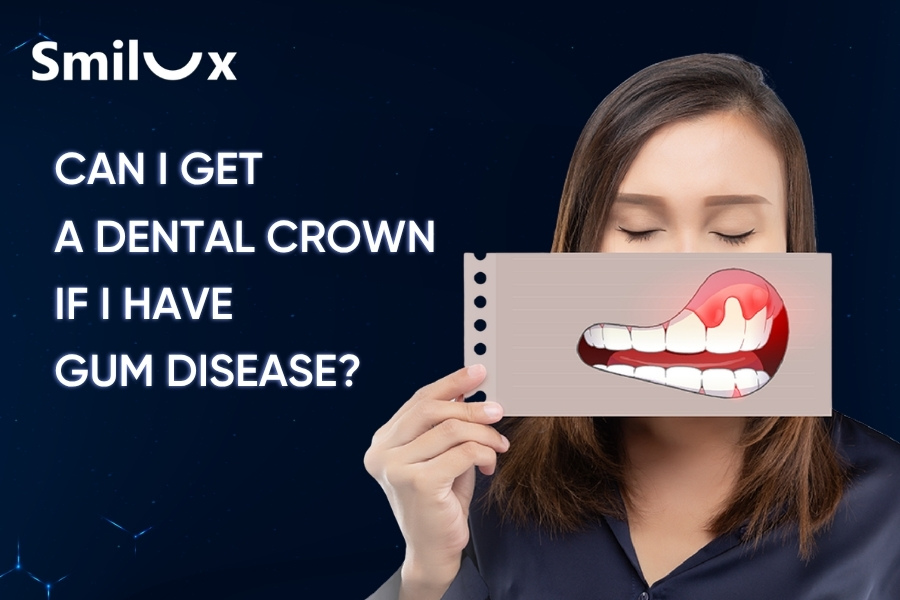 Can I get a dental crown if I have gum disease? Can I get a dental crown if I have gum disease?