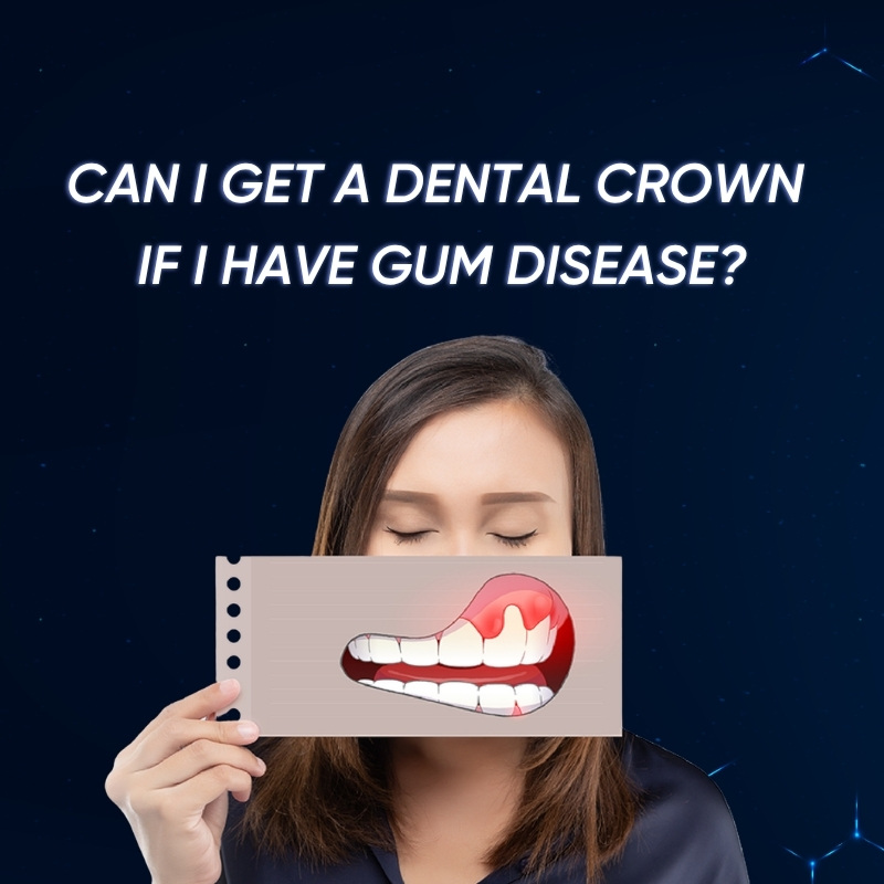 Can I get a dental crown if I have gum disease smilux