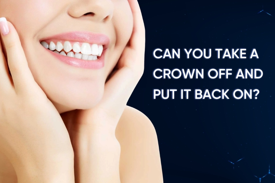 Can You Take a Crown Off and Put It Back On? Can You Take a Crown Off and Put It Back On?