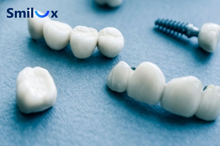 Không nên tự xử lý răng sứ bị rớt tại nhà Không nên tự xử lý răng sứ bị rớt tại nhà