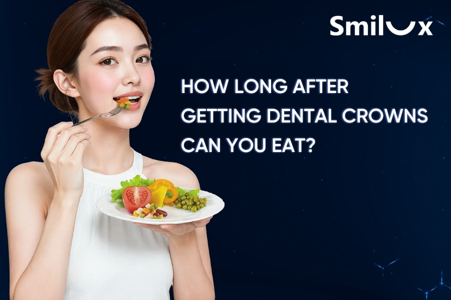 How Long After Getting Dental Crowns Can You Eat? How Long After Getting Dental Crowns Can You Eat?
