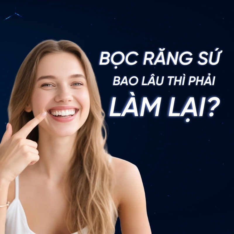 bọc răng sứ bao lâu thì phải làm lại smilux dental