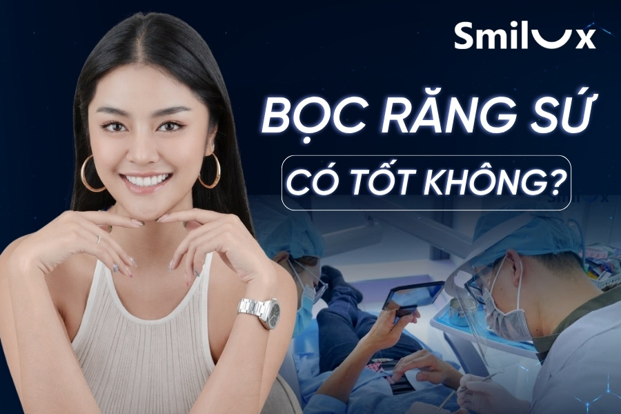 Bọc răng sứ có tốt không? Có nên bọc răng sứ không? Bọc răng sứ có tốt không? Có nên bọc răng sứ không?