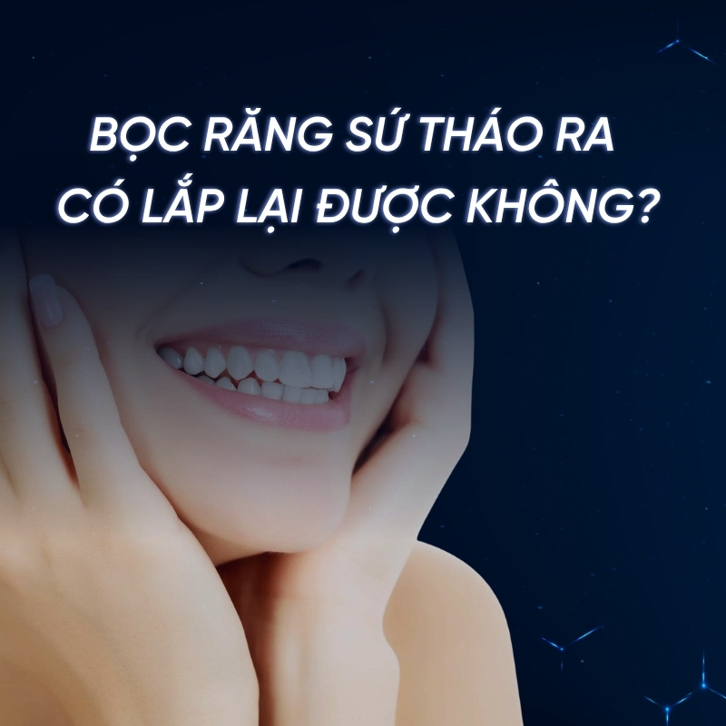 Bọc răng sứ tháo ra có lắp lại được không? Smilux giải đáp