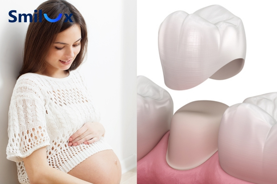 Phụ nữ mang thai nên hạn chế làm răng sứ thẩm mỹ khi không cần thiết Phụ nữ mang thai nên hạn chế làm răng sứ thẩm mỹ khi không cần thiết