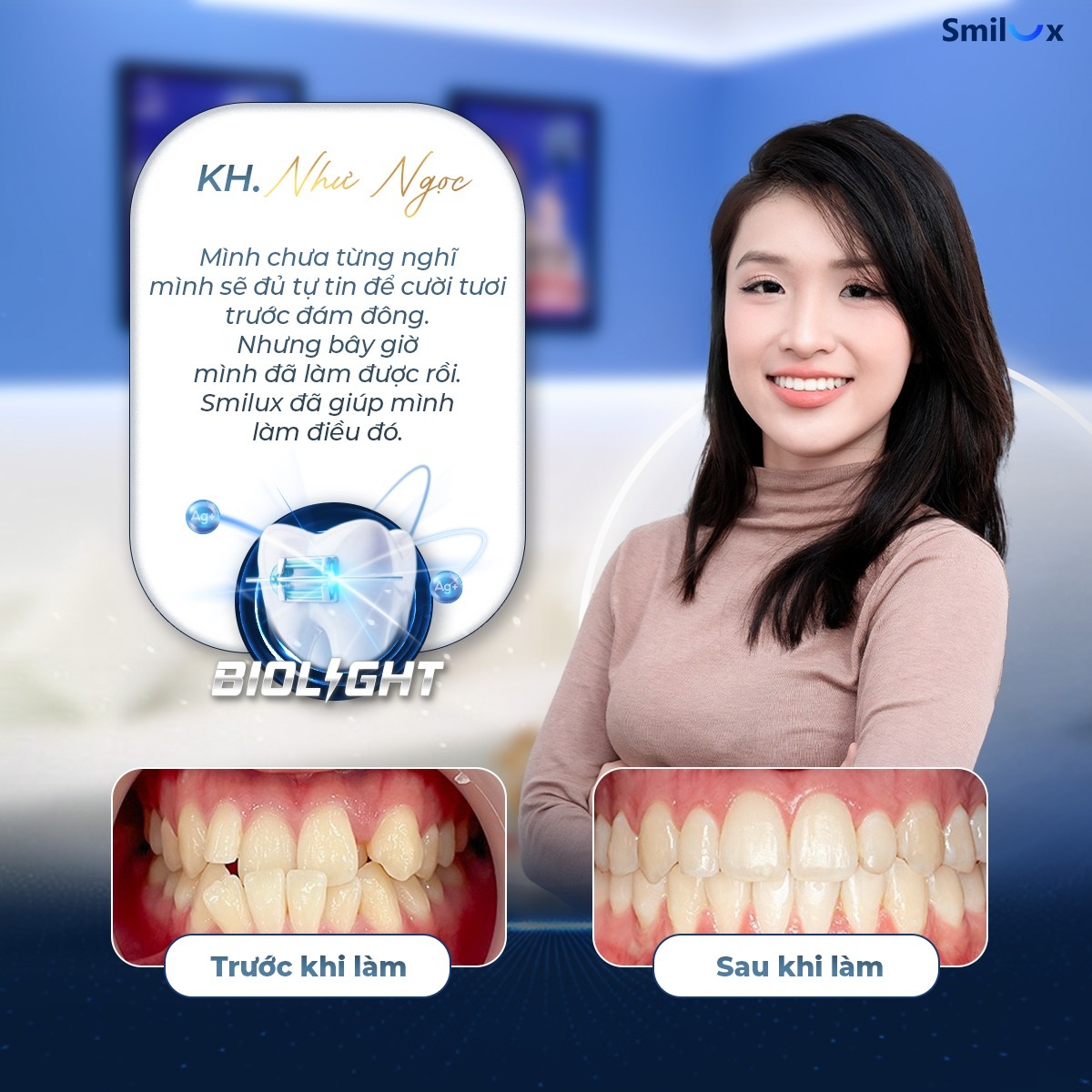 khách hàng thực tế niềng răng 2