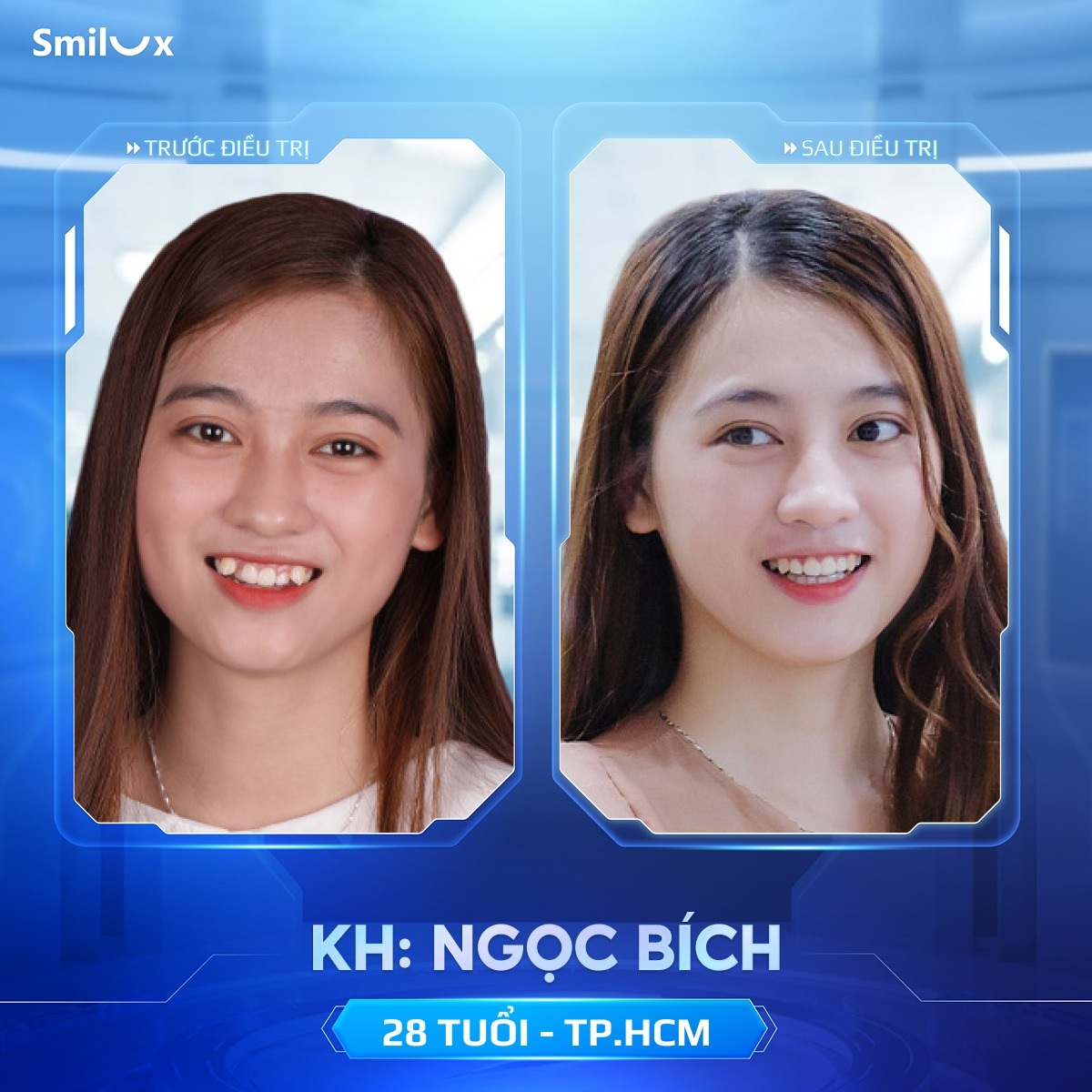 khách hàng thực tế niềng răng 5