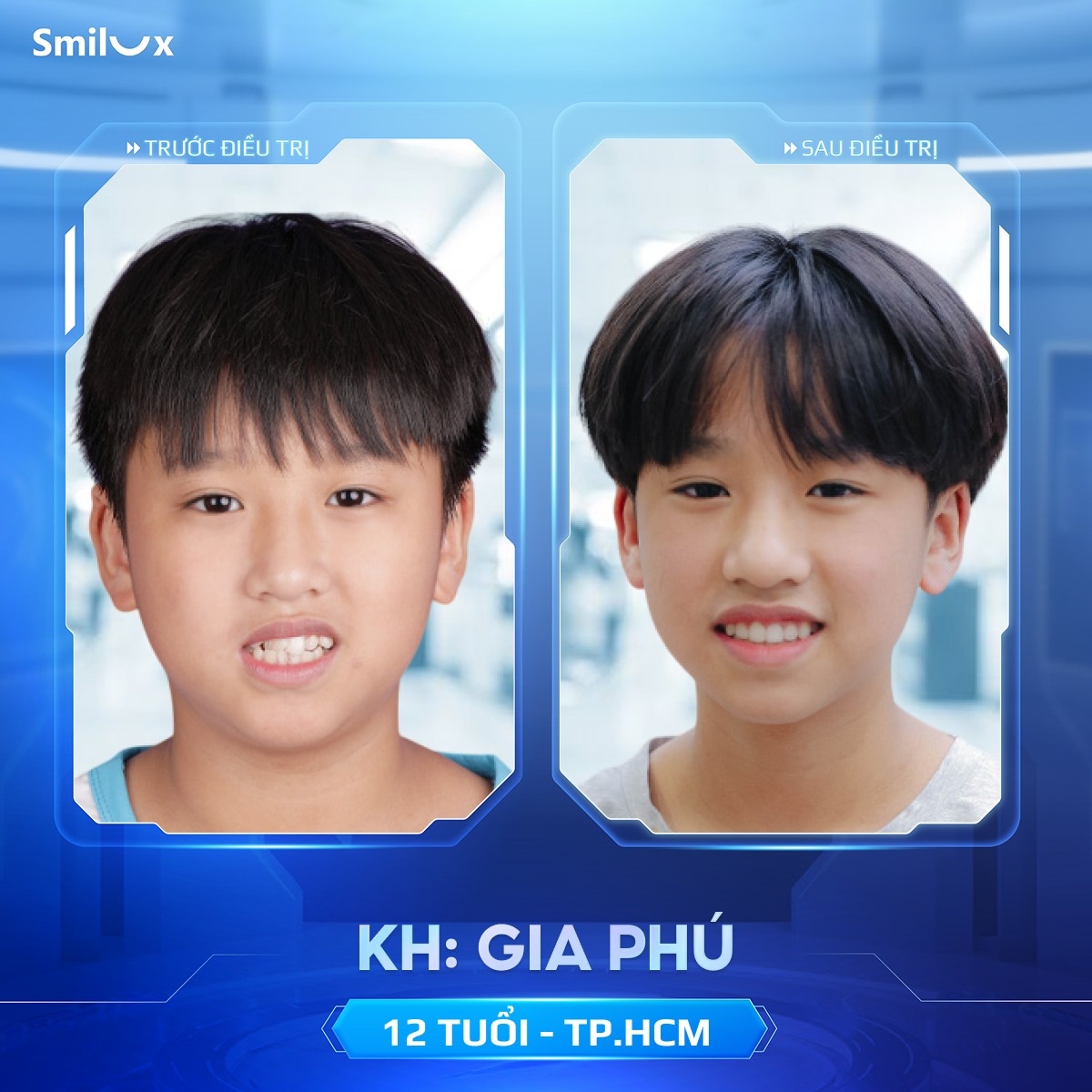 khách hàng thực tế niềng răng 6