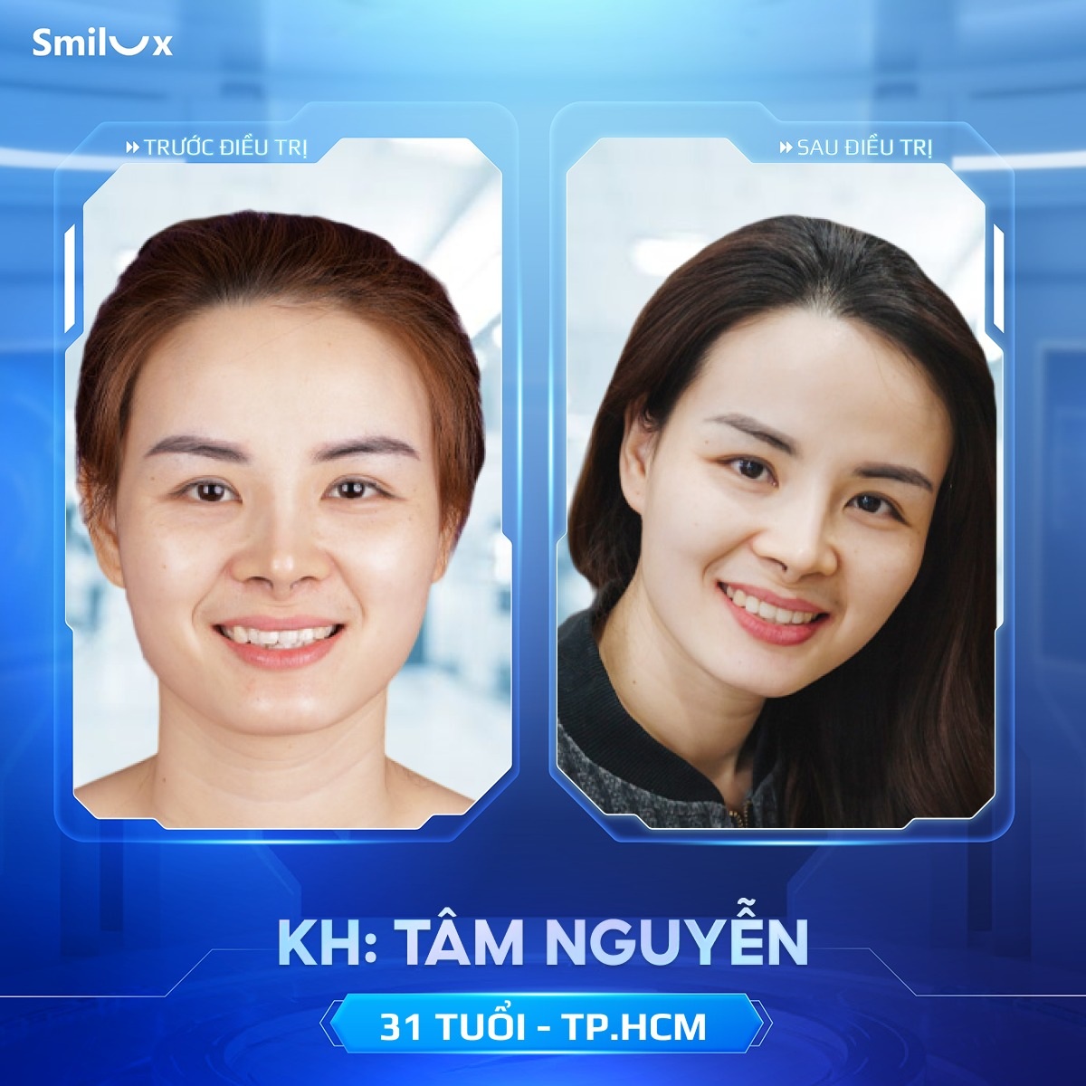 khách hàng thực tế niềng răng 7