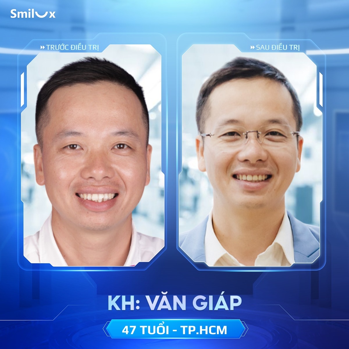 khách hàng thực tế niềng răng 8