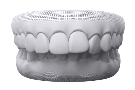 mô hình khớp cắn sâu