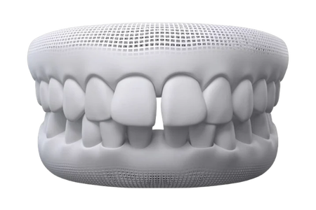 mo hinh rang bi thua