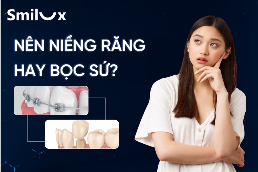 Nên niềng răng hay bọc sứ? Phương pháp nào tốt hơn? Nên niềng răng hay bọc sứ? Phương pháp nào tốt hơn?