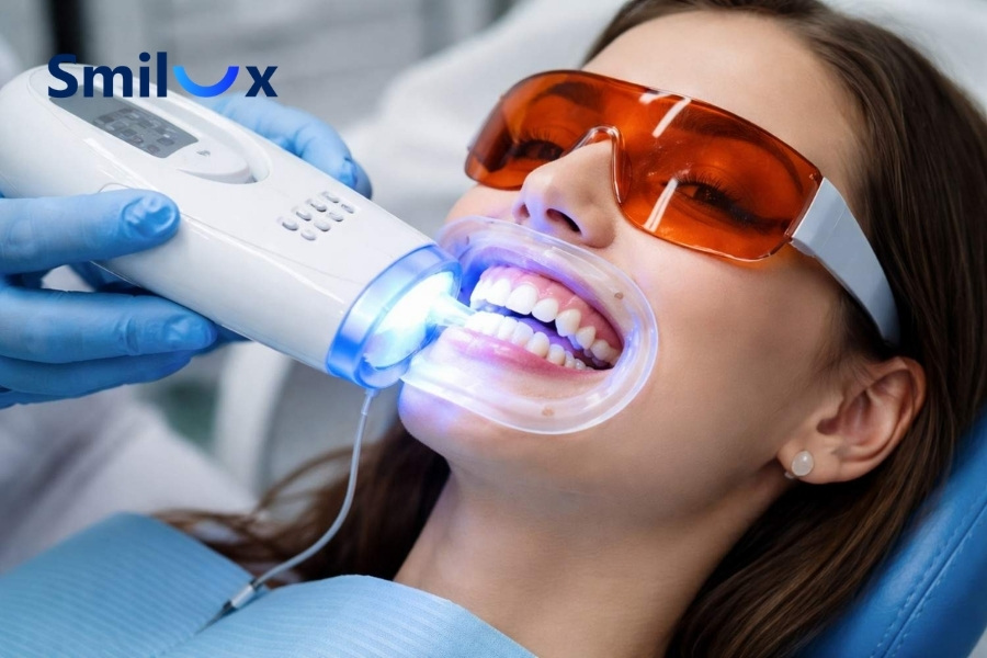 Tẩy trắng răng là gì? Tẩy trắng răng là gì?