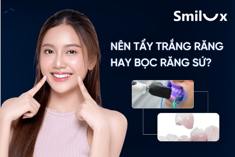 Nên tẩy trắng răng hay bọc sứ để răng hết bị ố vàng? Nên tẩy trắng răng hay bọc sứ để răng hết bị ố vàng?