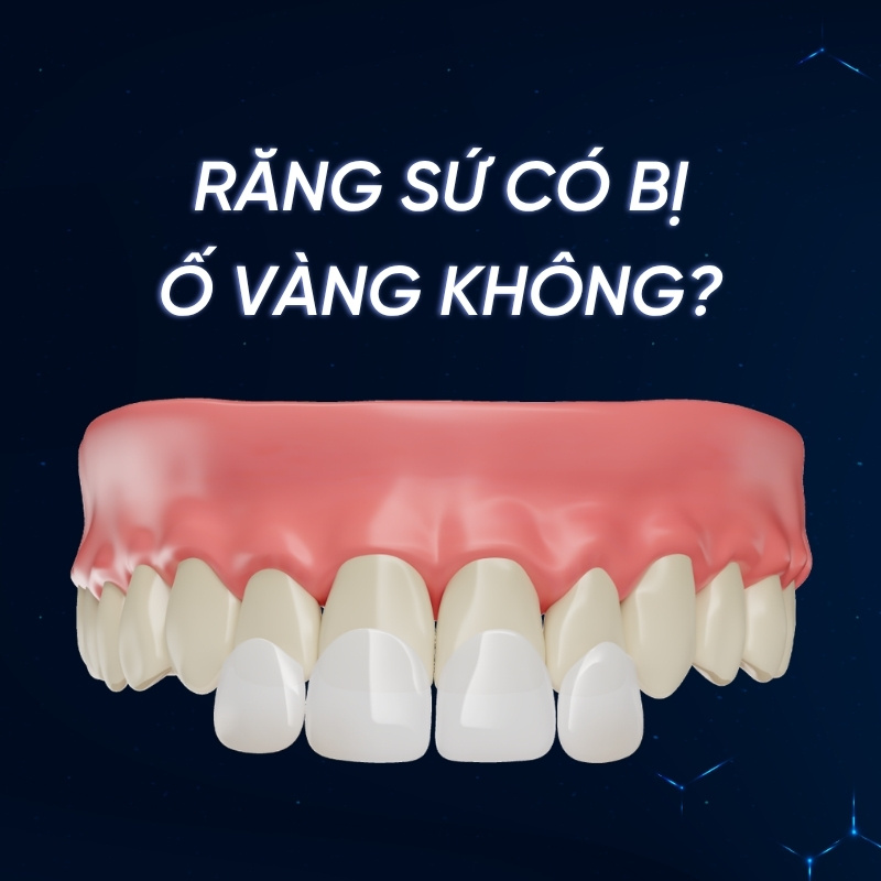 răng sứ có bị ố vàng không smilux dental