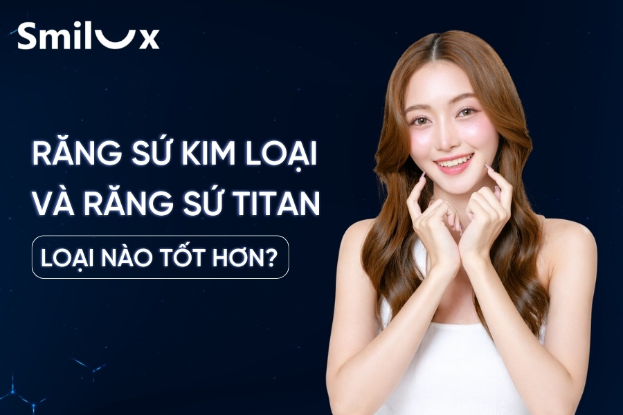 So sánh răng sứ kim loại và răng sứ Titan cái nào tốt hơn? So sánh răng sứ kim loại và răng sứ Titan cái nào tốt hơn?