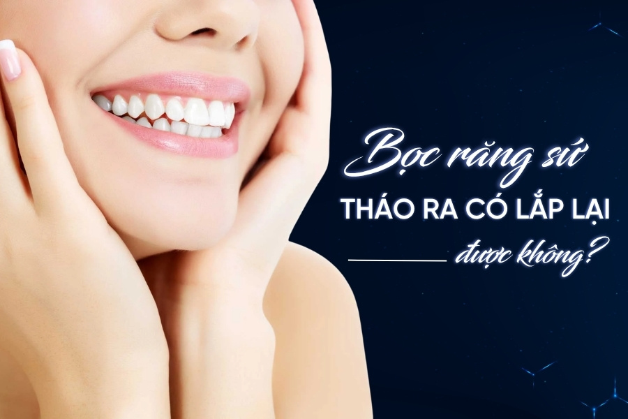 Bọc răng sứ tháo ra có lắp lại được không? Smilux giải đáp Bọc răng sứ tháo ra có lắp lại được không? Smilux giải đáp
