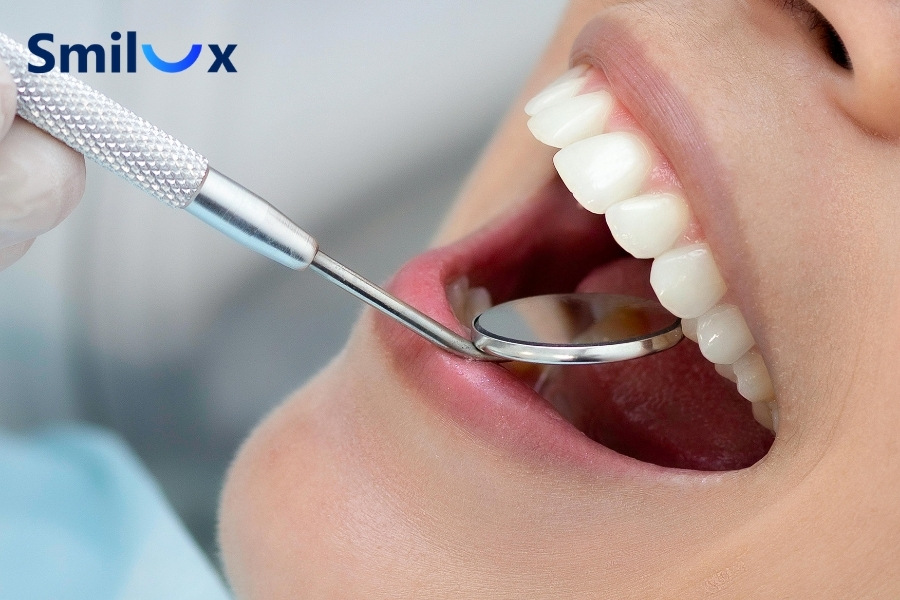 Nếu răng yếu, viêm tủy hoặc nha chu thì tuổi thọ răng sứ sẽ bị giảm đi Nếu răng yếu, viêm tủy hoặc nha chu thì tuổi thọ răng sứ sẽ bị giảm đi