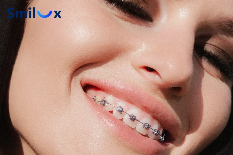 Răng miệng khỏe giúp rút ngắn thời gian niềng răng 1 hàm. Răng miệng khỏe giúp rút ngắn thời gian niềng răng 1 hàm.