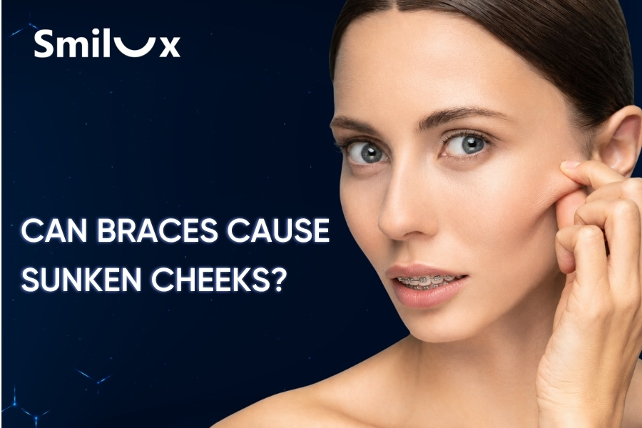 Can Braces Cause Sunken Cheeks? Causes and How to Improve It Can Braces Cause Sunken Cheeks? Causes and How to Improve It