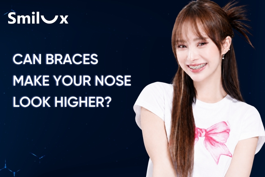 Can Braces Make Your Nose Look Higher? Smilux dentists explain Can Braces Make Your Nose Look Higher? Smilux dentists explain