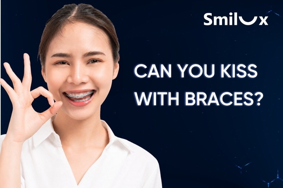 Can You Kiss with Braces? Smilux Dental’s Dentist Explains in Detail Can You Kiss with Braces? Smilux Dental’s Dentist Explains in Detail