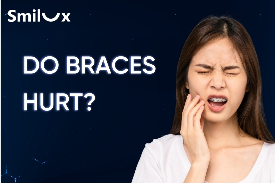 Do braces hurt? Which stage of orthodontic treatment is the most uncomfortable? Do braces hurt? Which stage of orthodontic treatment is the most uncomfortable?