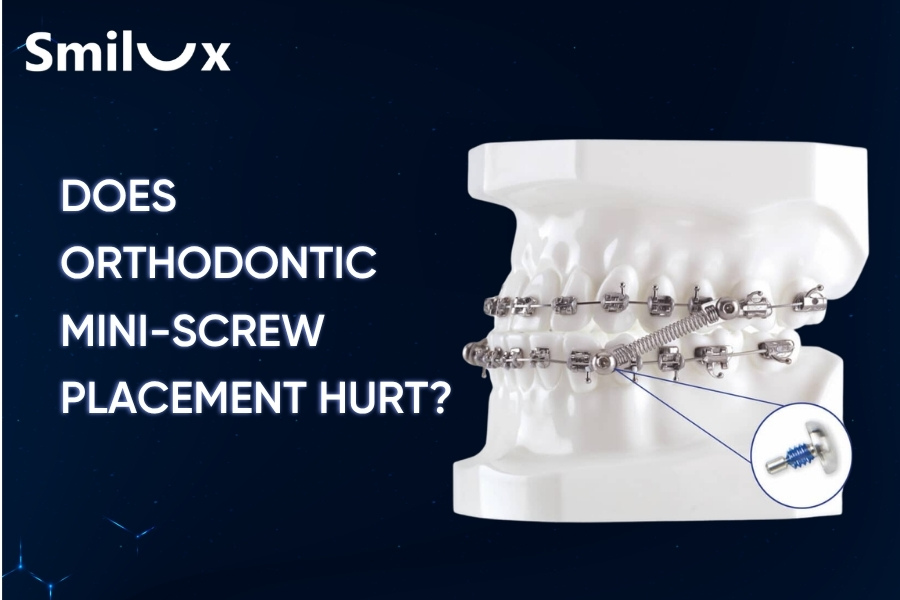 Does orthodontic mini-screw placement hurt? Smilux explains Does orthodontic mini-screw placement hurt? Smilux explains