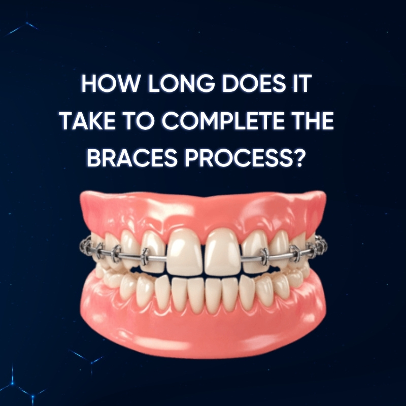 How Long Does It Take to Complete the Braces Process?