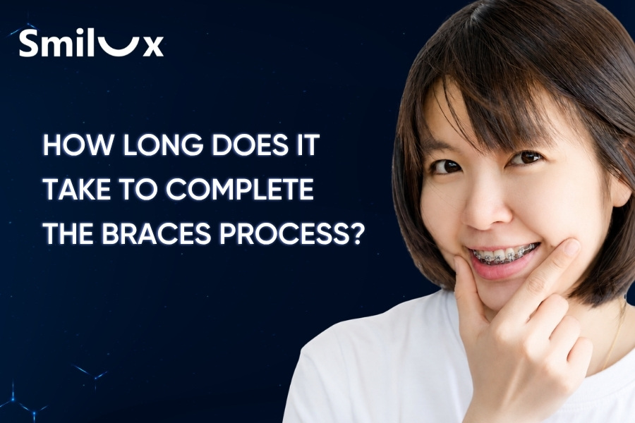 How Long Does It Take to Complete the Braces Process? How Long Does It Take to Complete the Braces Process?