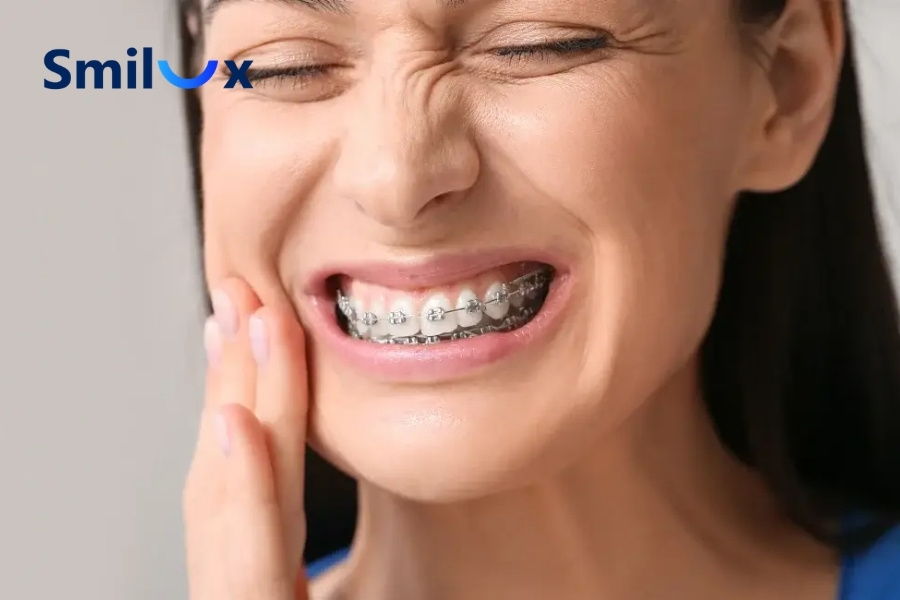 Thực tế, niềng răng có gây đau và khó chịu Thực tế, niềng răng có gây đau và khó chịu