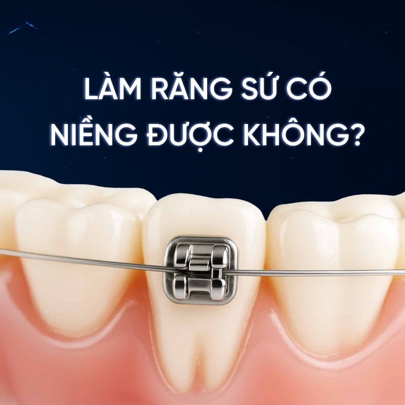 làm răng sứ có niềng được không smilux dental