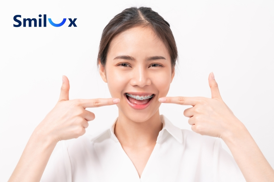 Mỗi phương pháp chỉnh nha mang lại mức độ đau khác nhau Mỗi phương pháp chỉnh nha mang lại mức độ đau khác nhau